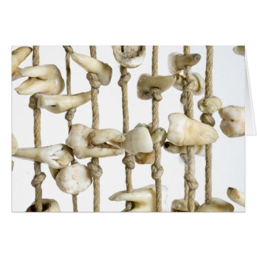 Funny Dental Photography Extracted Teeth Dentist (Front Horizontal)