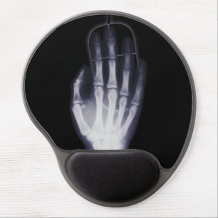 Funny Hand X-ray For internet addictioner Gel Mouse Pad