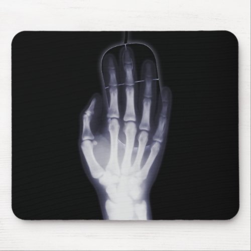 Funny Hand X_ray For internet addictioner Mouse Pad