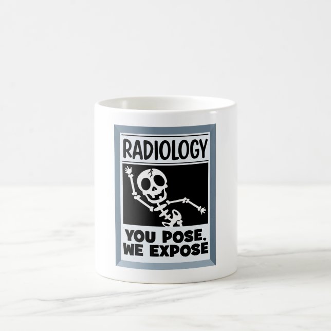 Funny Radiology Pun You Pose We Expose Coffee Mug (Center)