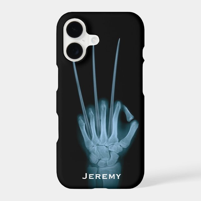Funny Wolverine Blades Hand Xray Iphone Case (Back)