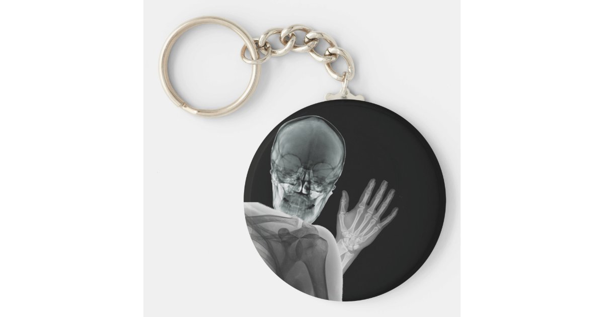 Funny Xray Photobomb Keychain | Zazzle.com