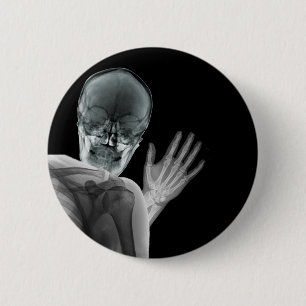 Funny Xray Photobomb Pinback Button