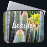 Fuzzy Green Cacti Succulent Photo Beauty Script Laptop Sleeve<br><div class="desc">Cacti thrive in the harshest of desert conditions. Dream of sunny days and the beauty of a summer’s garden whenever you use this stunning photography neoprene laptop sleeve. This laptop sleeve comes in three sizes: 15", 13", and 10”. Makes a great gift for someone special! You can easily personalize this...</div>