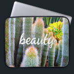 Fuzzy Green Cacti Succulent Photo Beauty Script Laptop Sleeve<br><div class="desc">Cacti thrive in the harshest of desert conditions. Dream of sunny days and the beauty of a summer’s garden whenever you use this stunning photography neoprene laptop sleeve. This laptop sleeve comes in three sizes: 15", 13", and 10”. Makes a great gift for someone special! You can easily personalize this...</div>