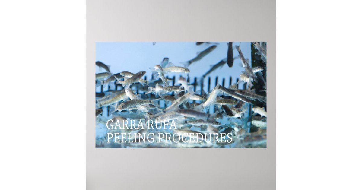 Garra rufa peeling poster | Zazzle