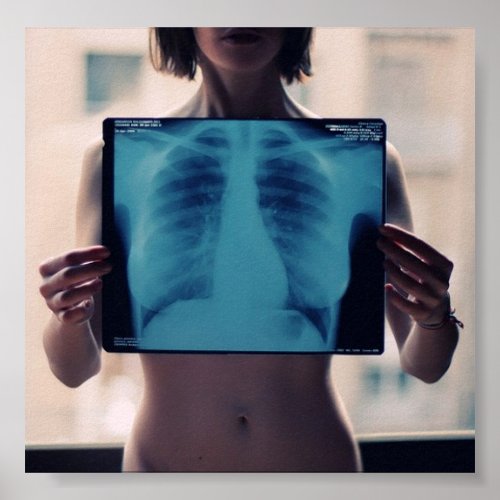 girls chest x_ray poster