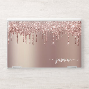 Girly Ombre Rose Gold Glitter Drips Metal Monogram HP Laptop Skin