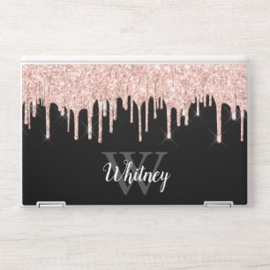 Girly Pink Glitter Drip Grey Monogram HP Laptop Skin