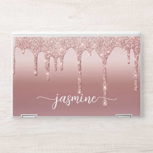 Girly Rose Gold Glitter Drips Metal Monogram HP Laptop Skin (Front)