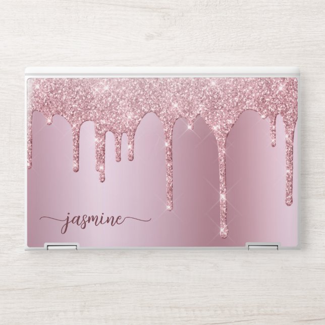 Girly Rose Gold Glitter Drips Ombre Metal Monogram HP Laptop Skin (Front)