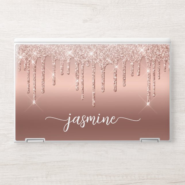 Girly Rose Gold Ombre Glitter Drips Metal Monogram HP Laptop Skin (Front)