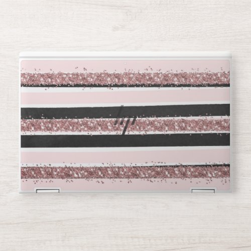 Girly Rose Gold Pink Black Glitter Stripes Pattern HP Laptop Skin