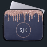 Glitter Drips Monogrammed Navy Blue Rose Gold Laptop Sleeve<br><div class="desc">Girly Blush Pink - Rose Gold and Navy Blue Faux Glitter Drips and Sparkle Elegant Monogrammed Initials Case. This case can be customized to include your initial and first name.</div>
