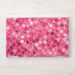 Glitter Pink Circles HP Laptop Skin Glitter Pink Circles HP Laptop Skin