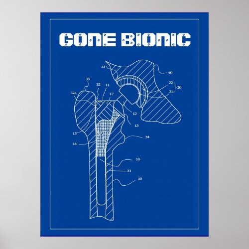 GONE BIONIC _ Hip Replacement Poster