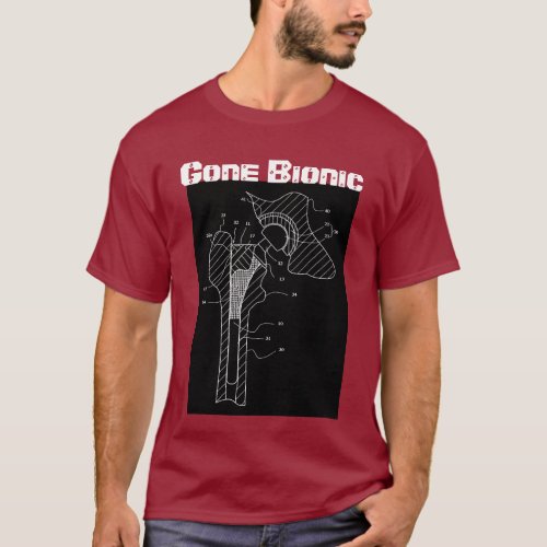 Gone Bionic _ Hip Replacement t_shirt