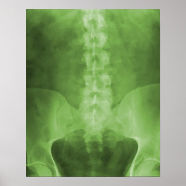 Green Digital X-Ray Art Print (Front)