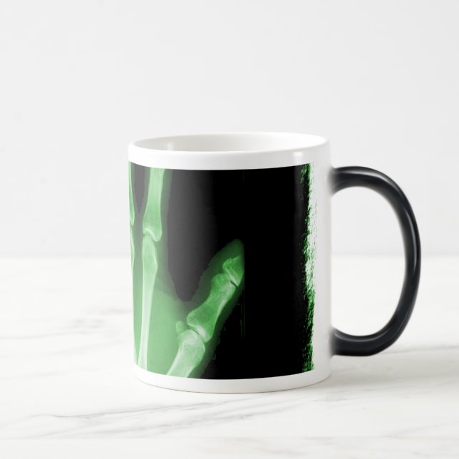 Green X-ray Skeleton Hand Color Morph Mug (Right)