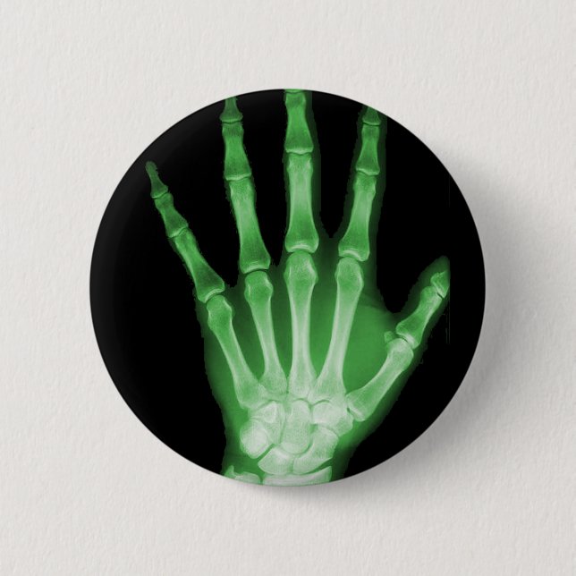 Green X-ray Skeleton Hand Pinback Button (Front)