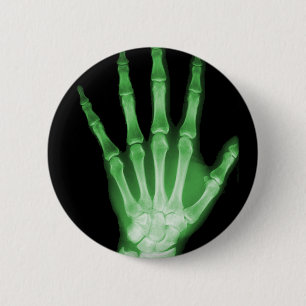 Green X-ray Skeleton Hand Pinback Button