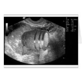 Guy's Card (Front Horizontal)