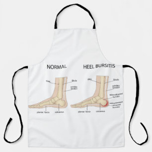 Haglund's deformity apron