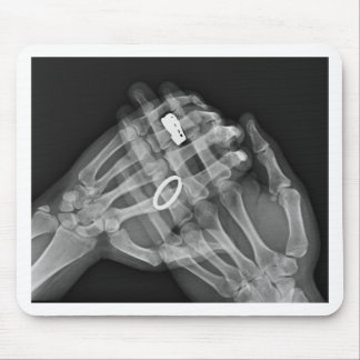 Hand Holding Mouse Pad