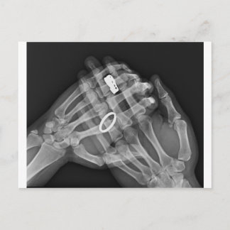 Hand Holding Postcard