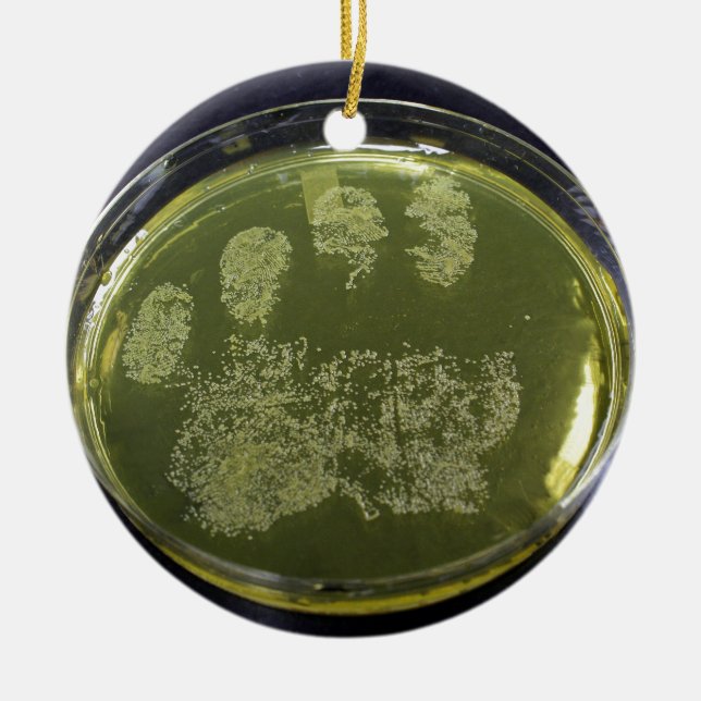 Hand Petri Dish Bacteria Ceramic Ornament (Front)