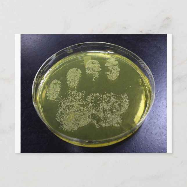 Hand Petri Dish Bacteria Postcard (Front)