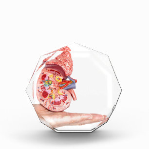 Hand showing model with inside of human kidney acrylic award