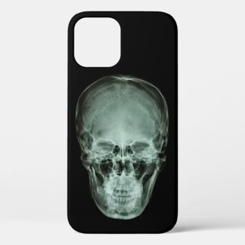 Head Skull X_Ray iPhone 12 Case