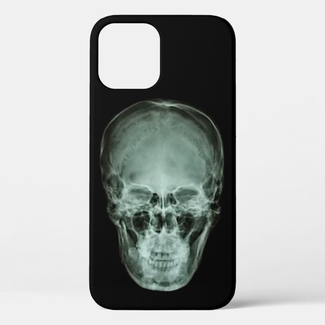 Head Skull X-Ray Case-Mate iPhone Case (Back)