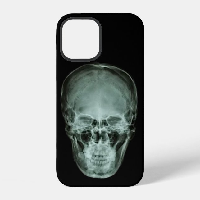 Head Skull X-Ray Iphone Case (Back)