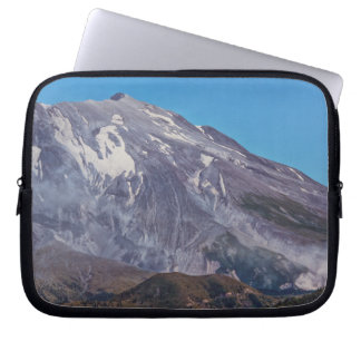 Helen's Scars Laptop Sleeve