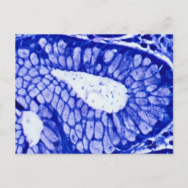 Helicobacter Pylori Postcard (Front)