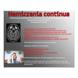 Hemicrania continua photo print
