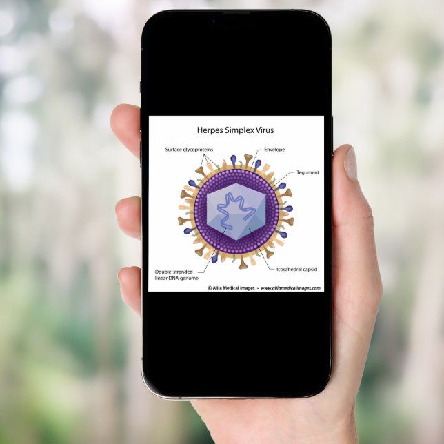 Herpesvirus labeled diagram. poster (Front Digital)