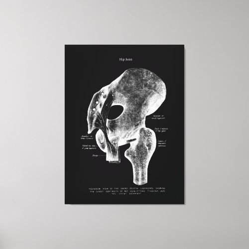 Hip Joint Anatomy Medical Large Canvas Art