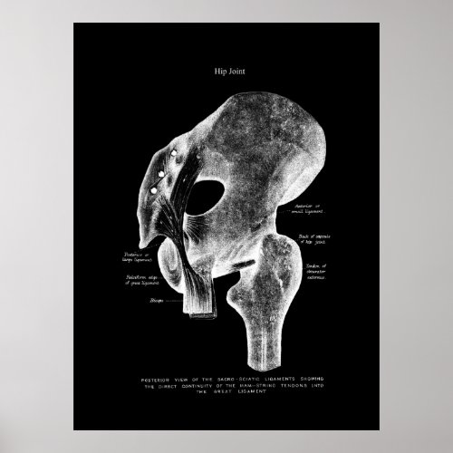 Hip Joint Anatomy Medical Poster