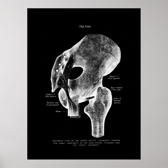 Hip Joint Anatomy Medical Poster (Front)