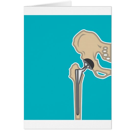 Hip Joint Replacement Cards (Front)