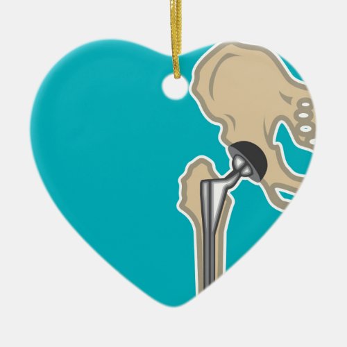 Hip Joint Replacement Ceramic Ornament