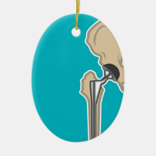 Hip Joint Replacement Ceramic Ornament