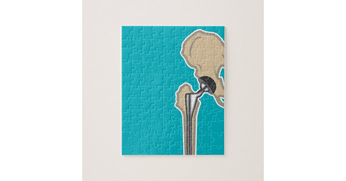 Hip Joint Replacement Jigsaw Puzzle Zazzle