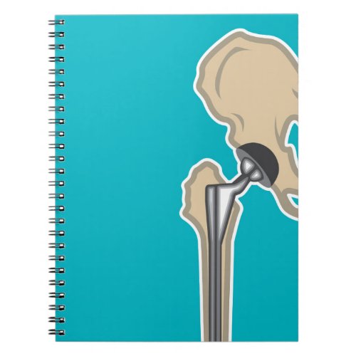 Hip Joint Replacement Notebook