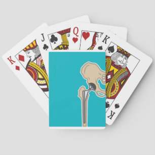 Hip Joint Replacement Poker Cards