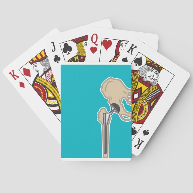 Hip Joint Replacement Poker Cards (Back)