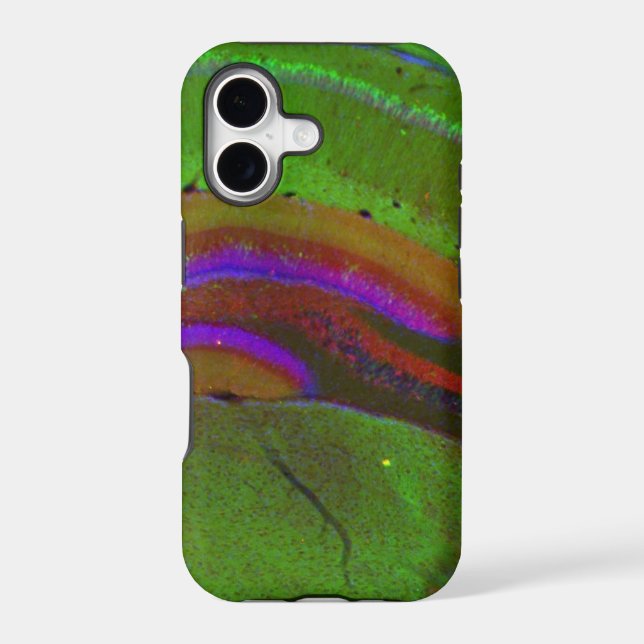 Hippocampal neurons iphone case (Back)